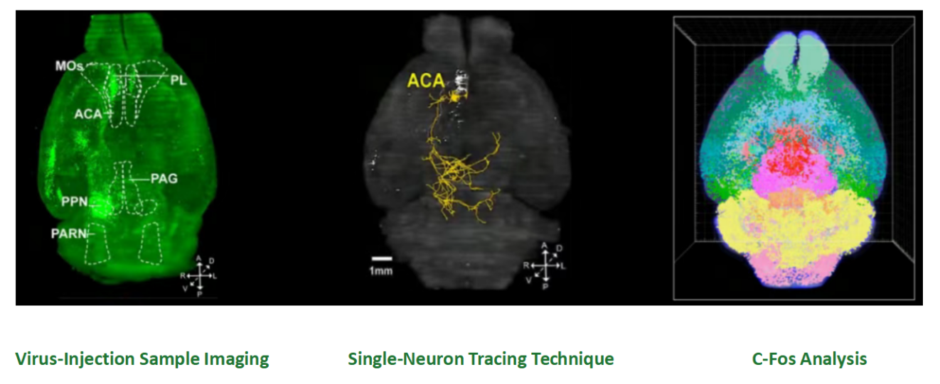 Research Service | Whole-Brain Clearing Imaging & Analysis Service