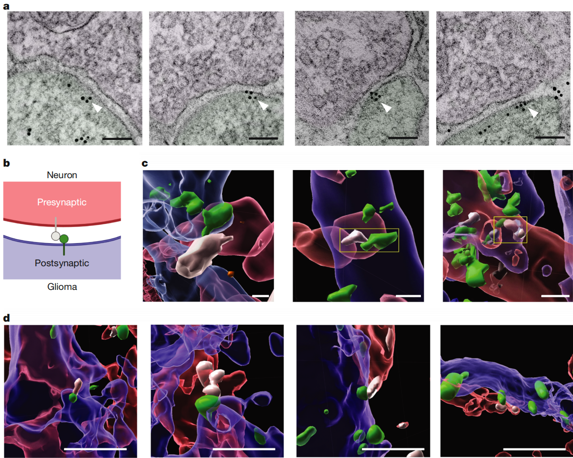 Literature Review | Major Nature Discovery: GABAergic Neurons Drive Diffuse Midline Glioma Growth via Synaptic Signaling