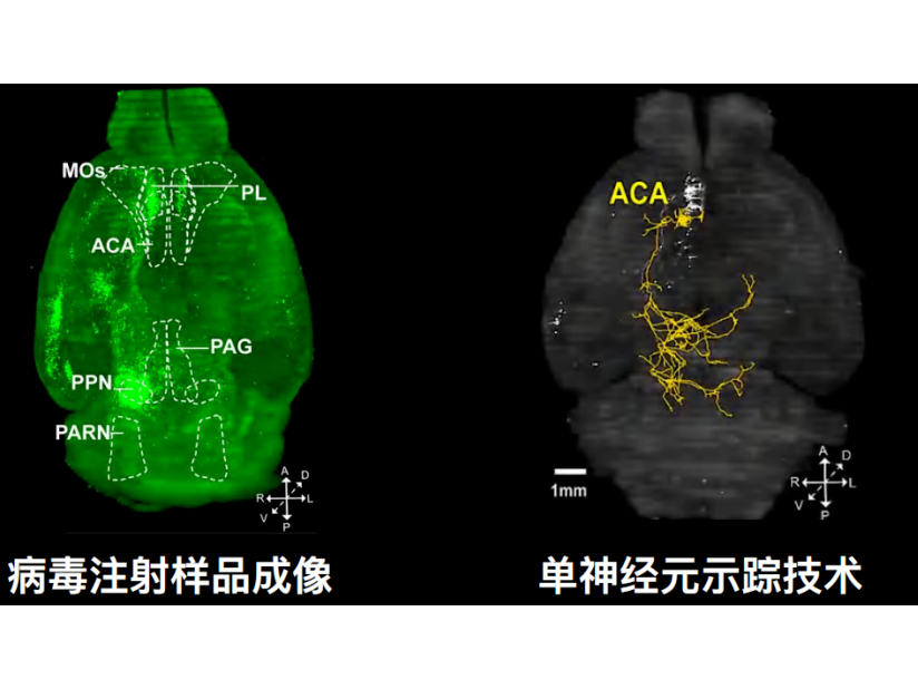 科研服务|全脑透明化成像与分析服务（二）