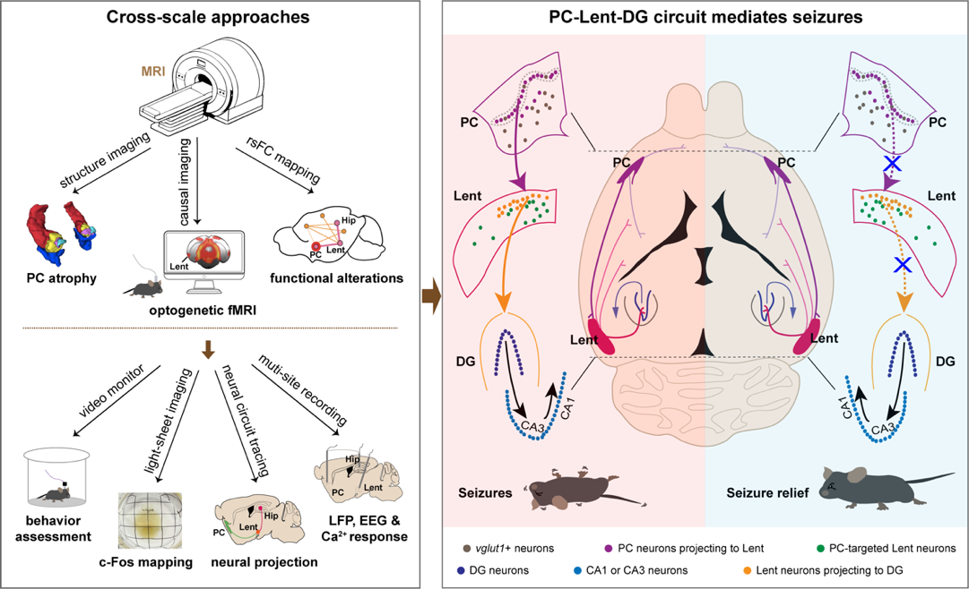 岁末新呈 | 癫痫治疗新思路：复旦大学吴瑞琪团队揭示介导梨状癫痫发作并驱动全脑功能重组的关键环路