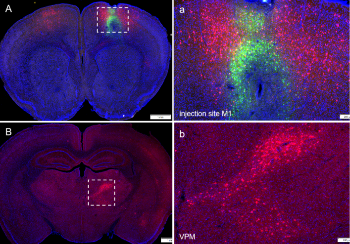 Experimental Tips: Rabies virus (RV) Retrograde Trans-Synaptic Labeling System User Guide