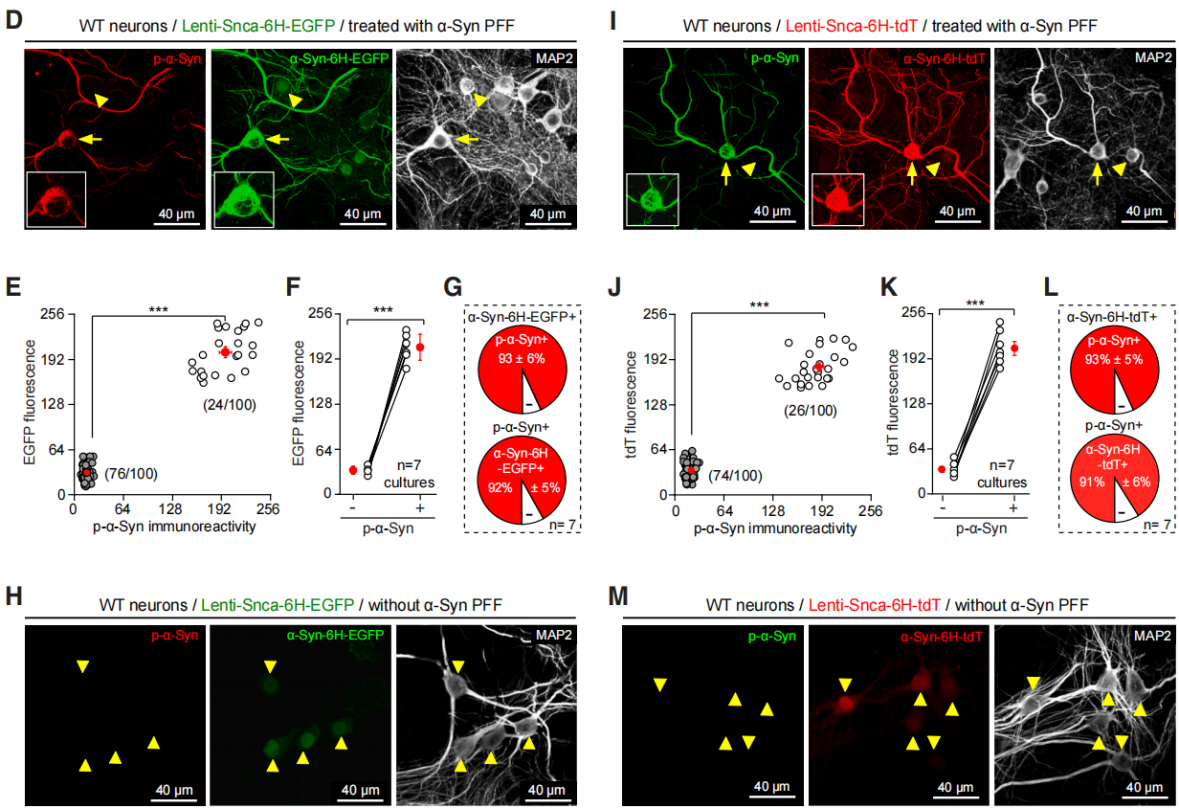 A New Tool for Visualizing α-Syn Aggregates in Live Brains—α-Syn-6H-EGFP/tdT sensor Experiment Guide