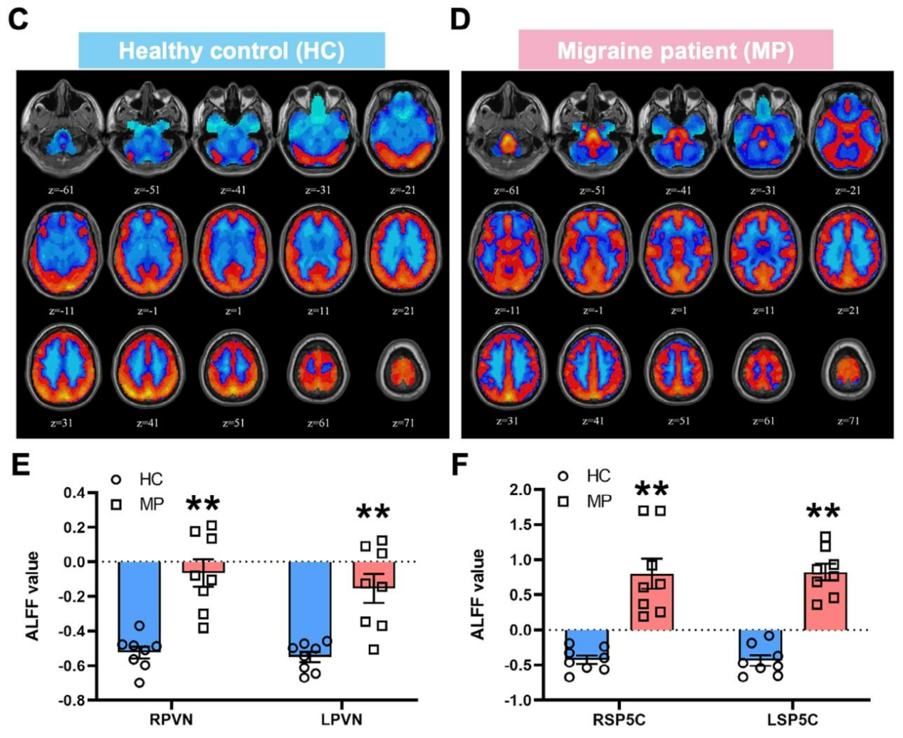 客户文章 | Adv. Sci. | 青岛大学徐许峰/河南省人民医院王梅云、靖旭团队合作揭示下丘脑CRF神经元调控偏头痛的新机制