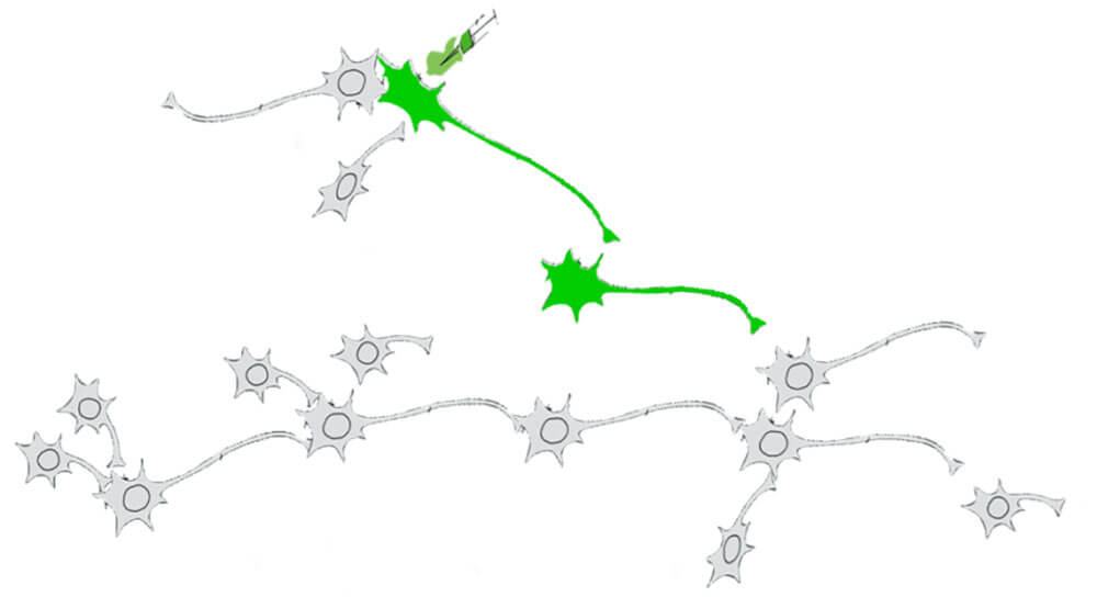 Anterograde Mono-synaptic Tracing - Brain Case